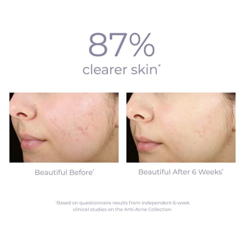 Derma E Blemish & Acne Treatment - Soothing Salicylic Acid & Sulfur Formula - 1 Fl Oz
