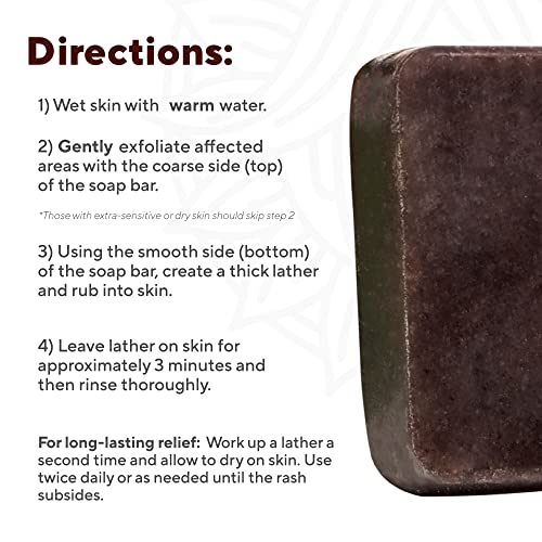 Marie Originals Body Soap - Natural Relief for Itchy Skin, Gentle Ingredients - 4oz Bar