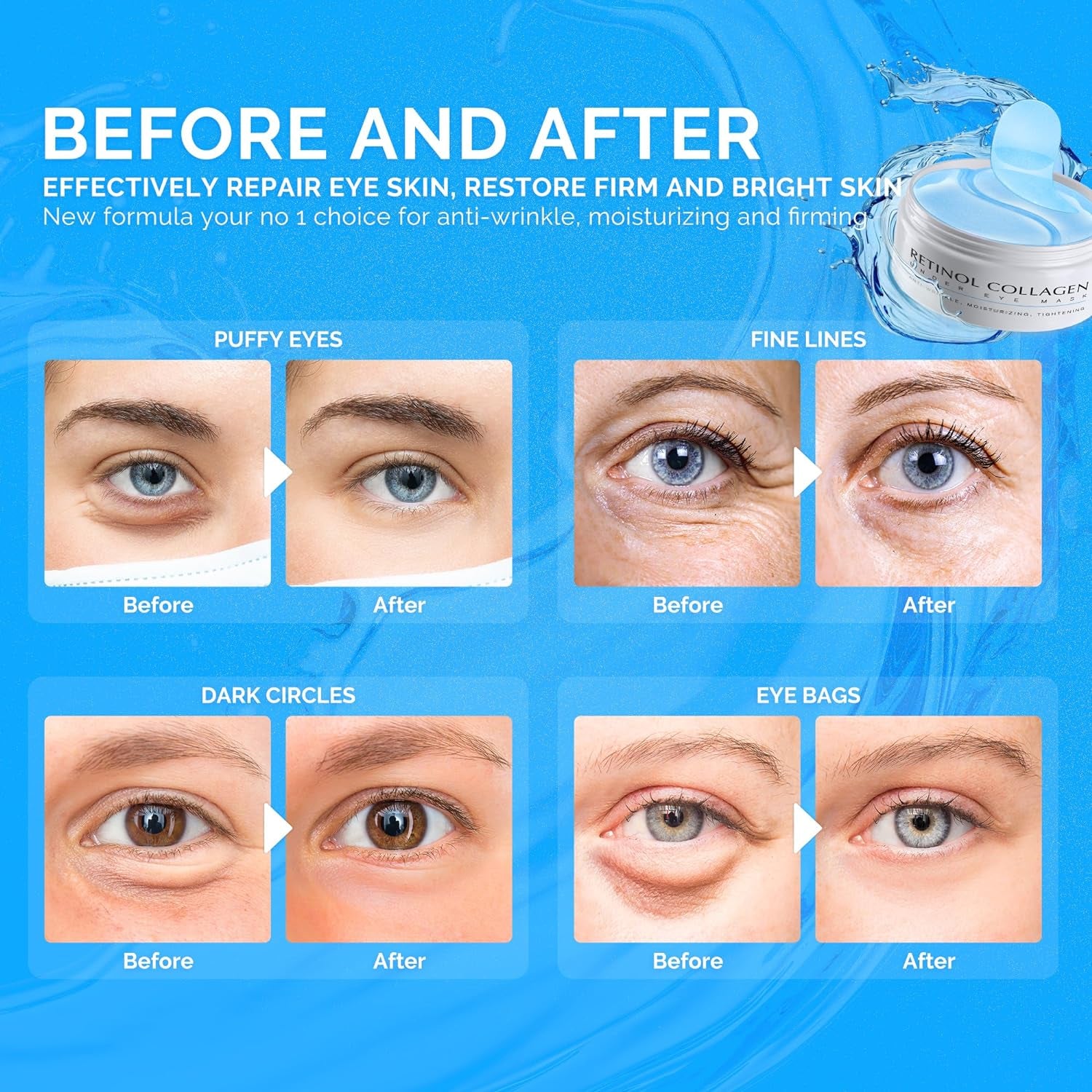 under Eye Patches for Dark Circles: 30 Pairs Retinol Collagen Eye Gels Mask - Reduce Wrinkles Puffy & Bags - Skin Treatment Pads - anti Aging Moisturizer for Women (Blue)