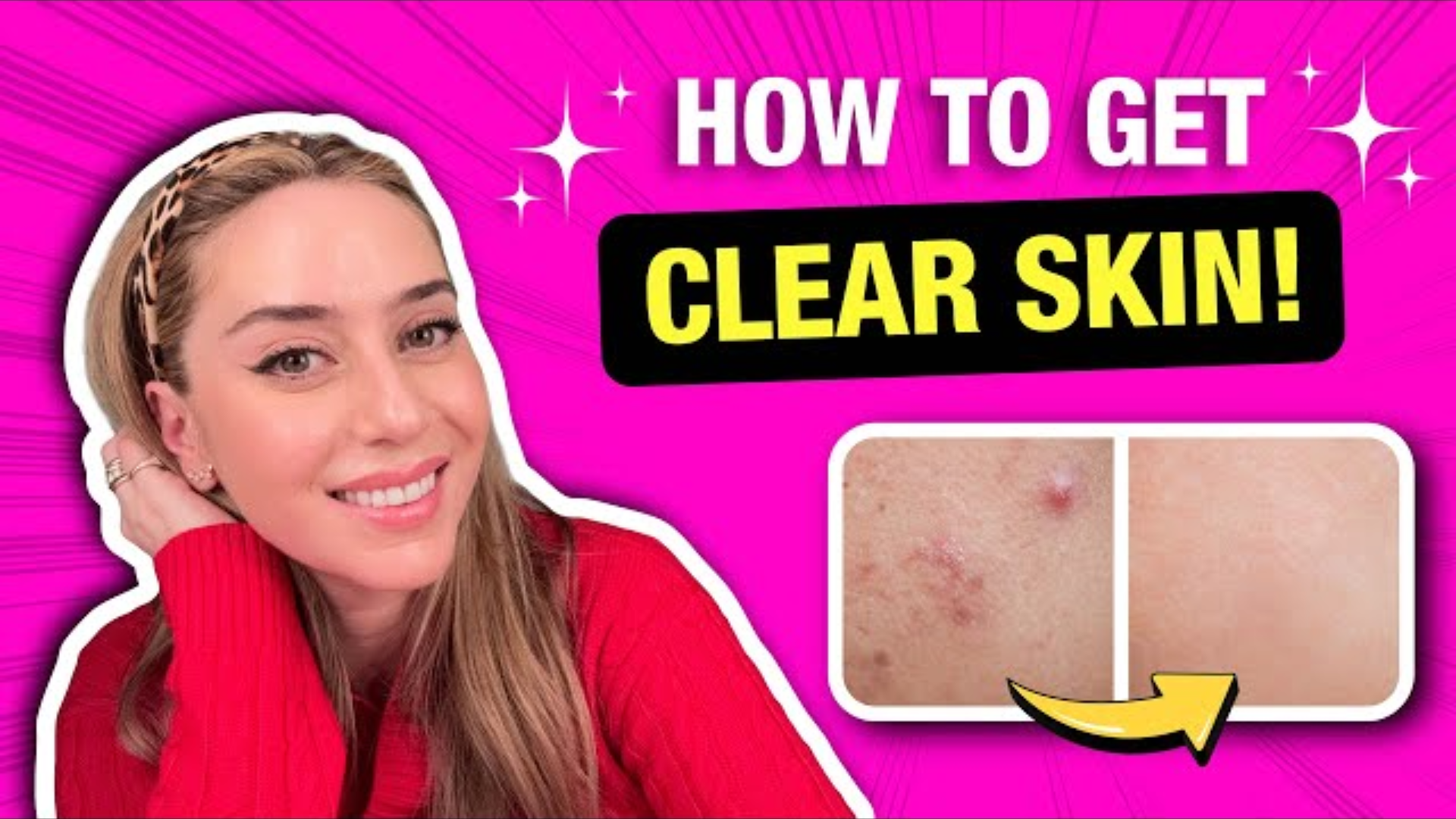 Best Clear Skin Tips from a Dermatologist That Actually Work