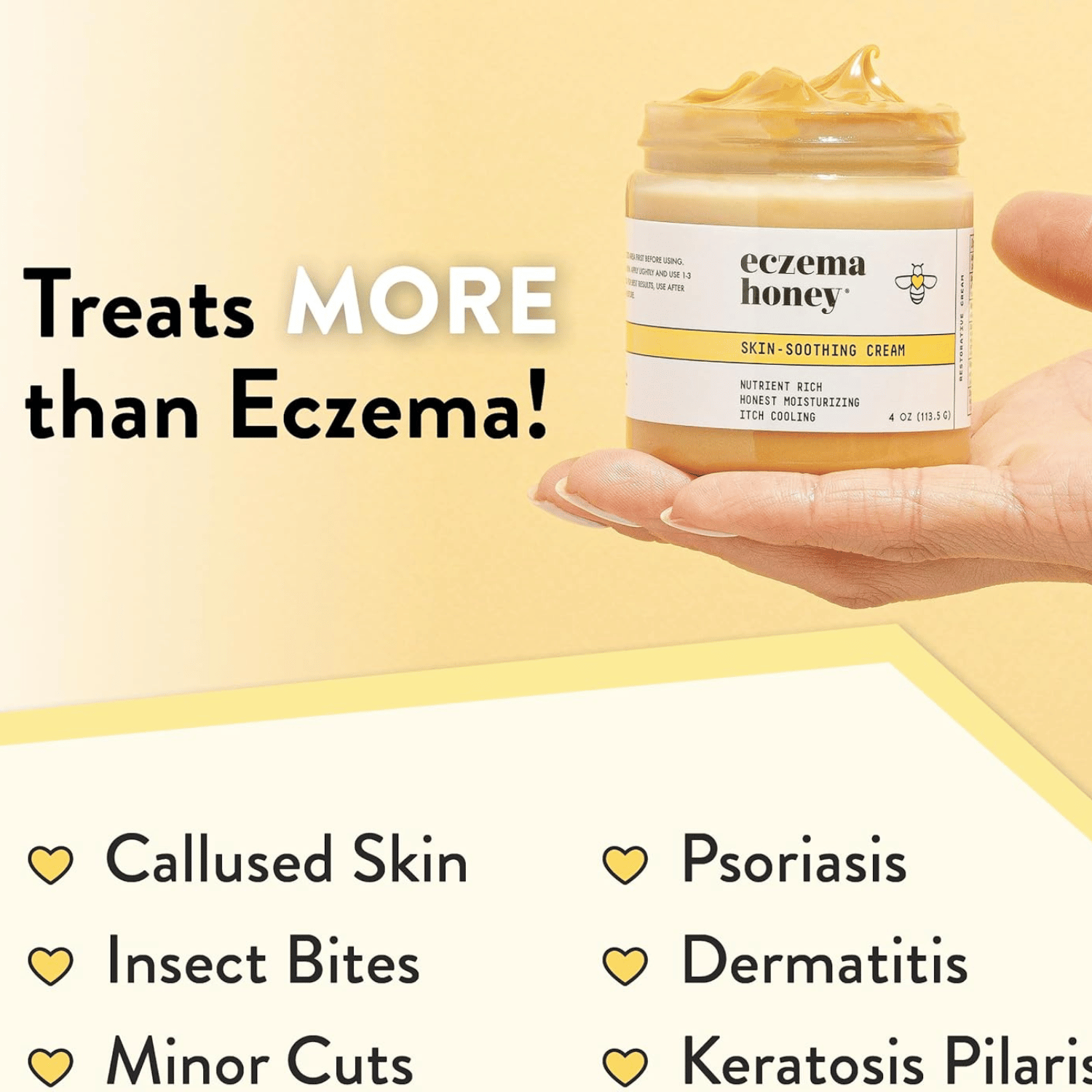 ECZEMA HONEY Skin-Soothing Cream - Natural Relief for Dry, Itchy Skin, 4 Oz