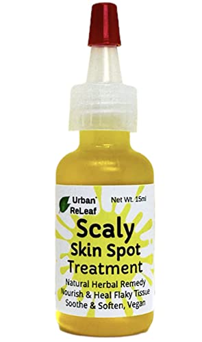 Urban ReLeaf Body Oil - Natural Relief for Dry, Flaky Skin, Nourishing Oils - 15ml