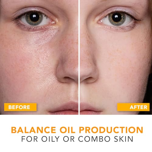 Oil Control Face Moisturizer - Lightweight Hydration with Niacinamide, USA Made - 4oz