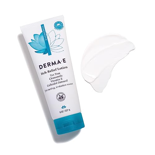 DERMA-E Itch Relief Lotion - Calming Moisturizer for Dry Skin with Natural Ingredients - 8 oz