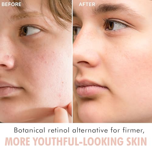 Bakuchiol Face Serum - Plant-Based Retinol Alternative, Reduces Fine Lines, 1.0 oz