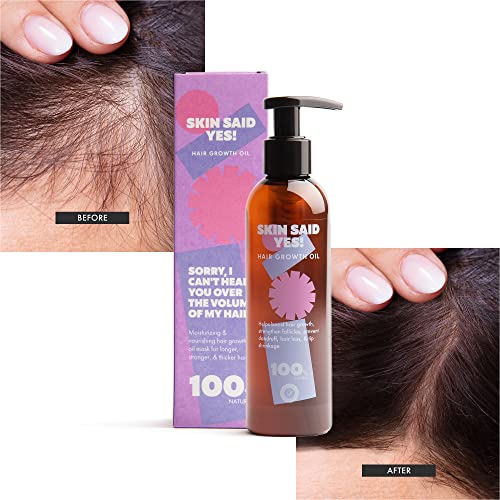 Skin Said Yes Hair Growth Oil Serum - Organic, Vegan, Dermatologically Tested - 4oz