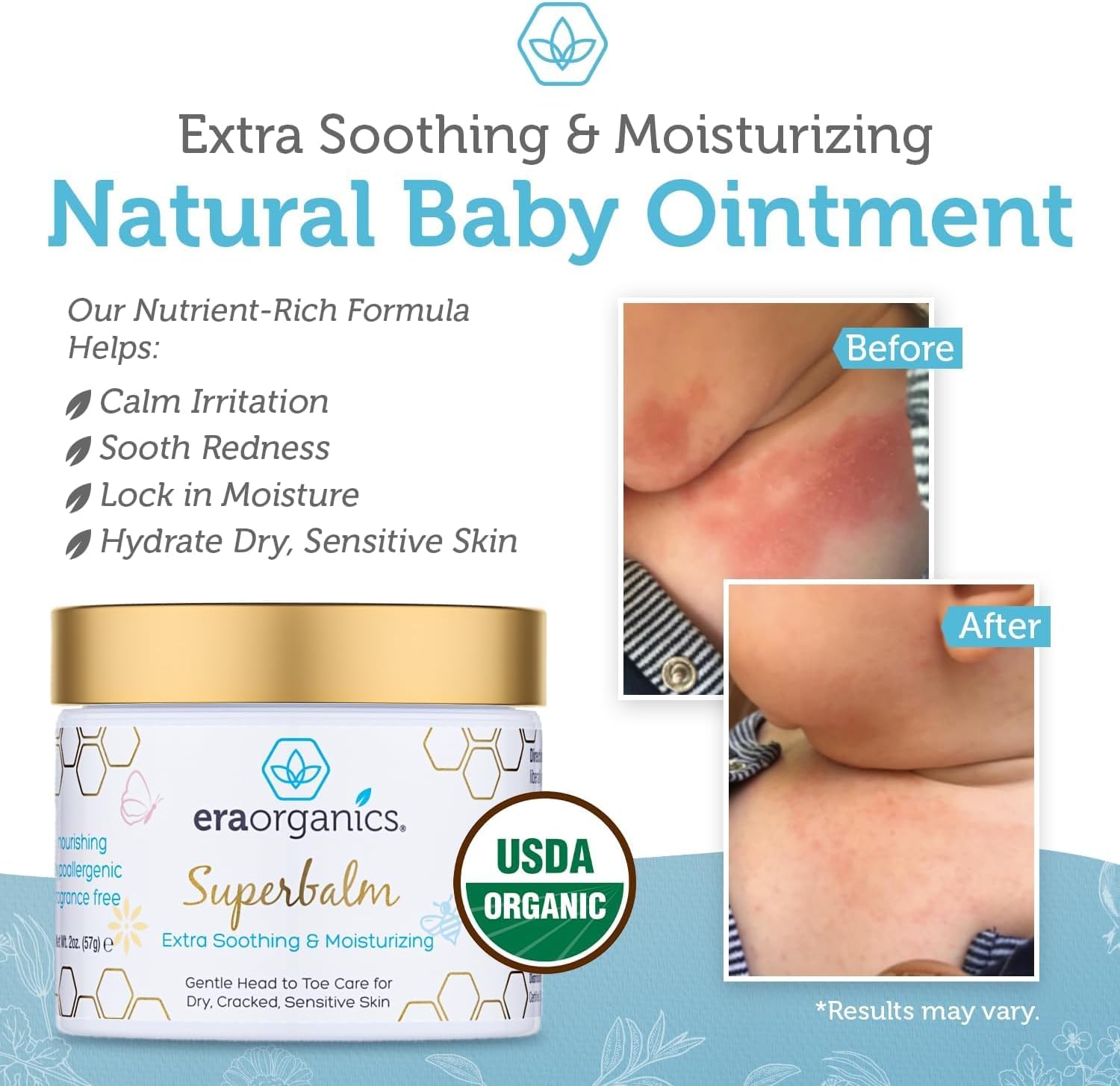 Era Organics Baby Moisturizing Cream - USDA Organic, Soothes Eczema & Rashes, 4oz