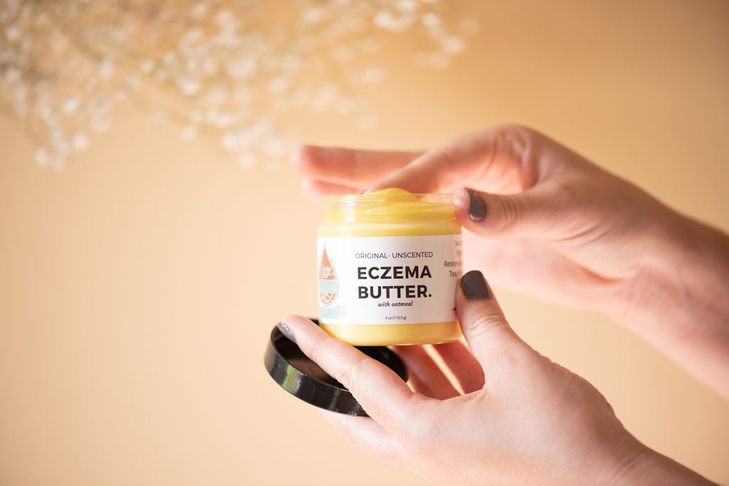 Lizzies All Natural Eczema Butter